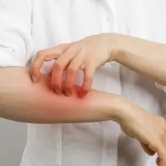 Person se gratte le bras, rougeur et irritation suggérant une allergie au chlore.