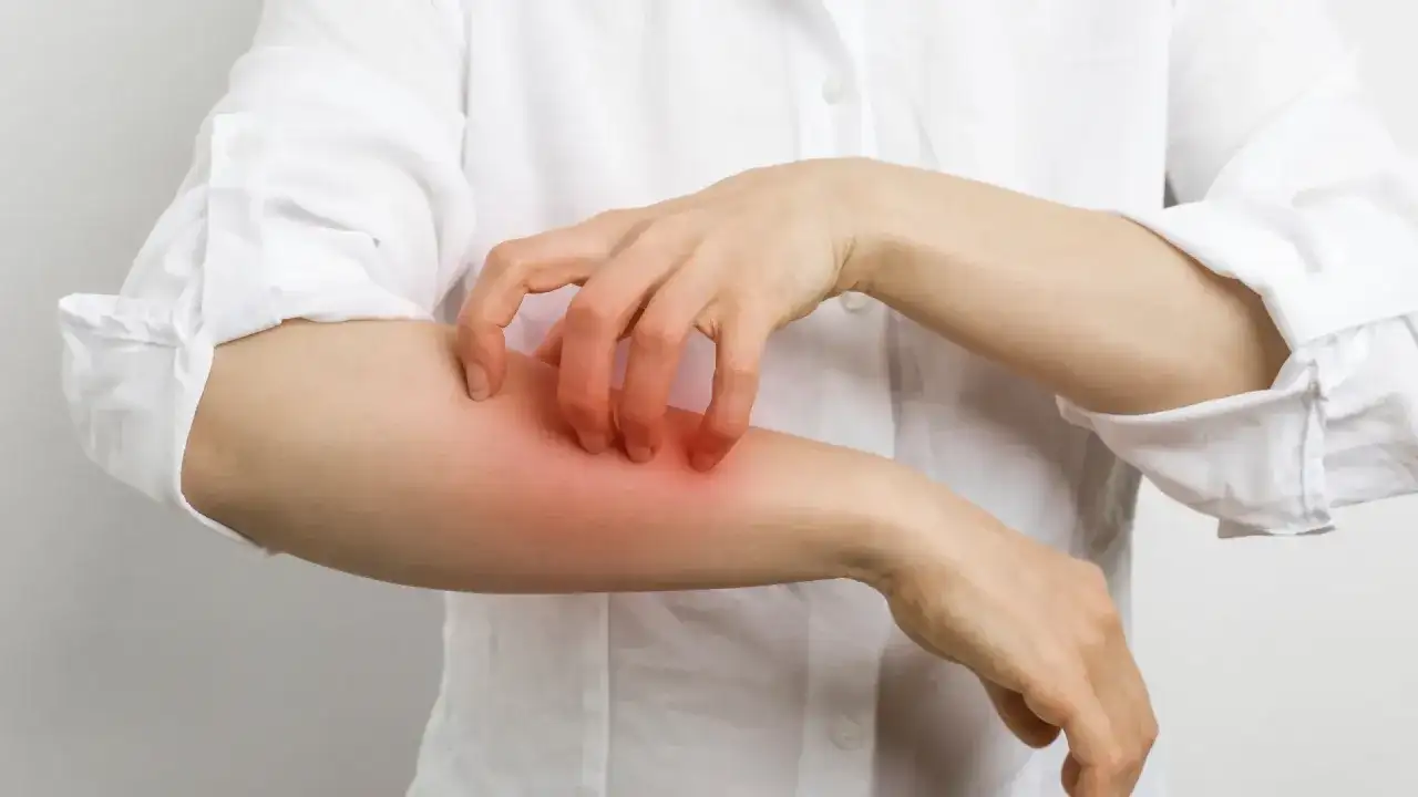 Allergie au chlore après la piscine - irritation ou vraie allergie ?