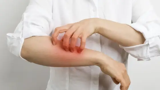 Allergie au chlore après la piscine - irritation ou vraie allergie ?